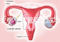 遵義哪個試管嬰兒成功率高？貴州生殖中心醫院2024年排名參考