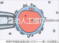 重慶婦幼人工授精一次成功率揭秘，移植費用貴有原因