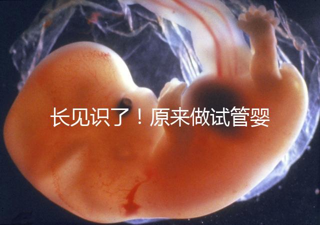 長見識(shí)了！原來做試管嬰兒，精子是這樣被篩選出來的