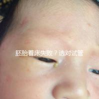 胚胎著床失敗？選對試管嬰兒醫生很重要