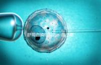 臍帶血捐贈后萬一自己要用怎么要早知，懷孕的趁早了解