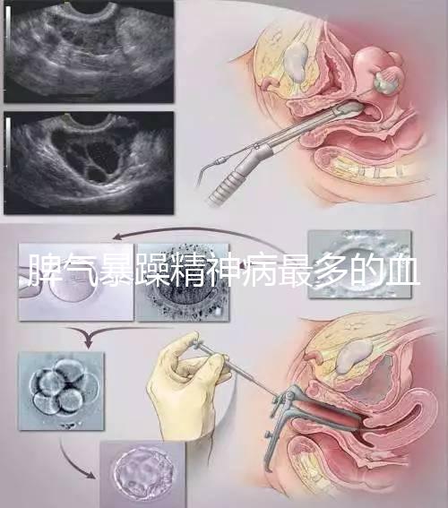 脾氣暴躁精神病最多的血型竟是…，4大血型隱藏了不同疾病