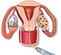 蘇打片生男孩3大用法公布，同房塞陰還是口服分情況