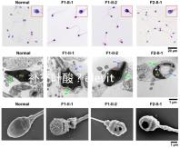 補(bǔ)充葉酸？elevit愛樂維那你不得不了解