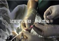 試管嬰兒答疑：什么情況下需要進行PGS和PGD？