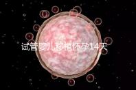 試管嬰兒移植懷孕14天，還能吃巧克力餅干嗎？