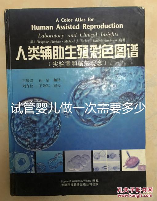 試管嬰兒做一次需要多少錢(qián)