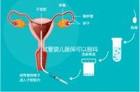 試管嬰兒醫?？梢詧髥? /></a></div><dfn lang=