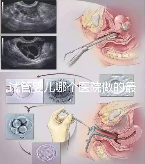 試管嬰兒哪個醫(yī)院做的最好呢？多家權(quán)威機(jī)構(gòu)推薦