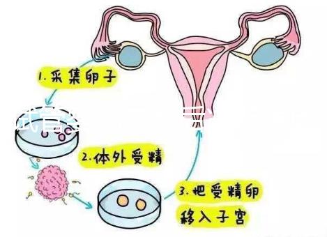 試管嬰兒二超后減藥原因已找到，對胎兒沒影響別瞎擔心