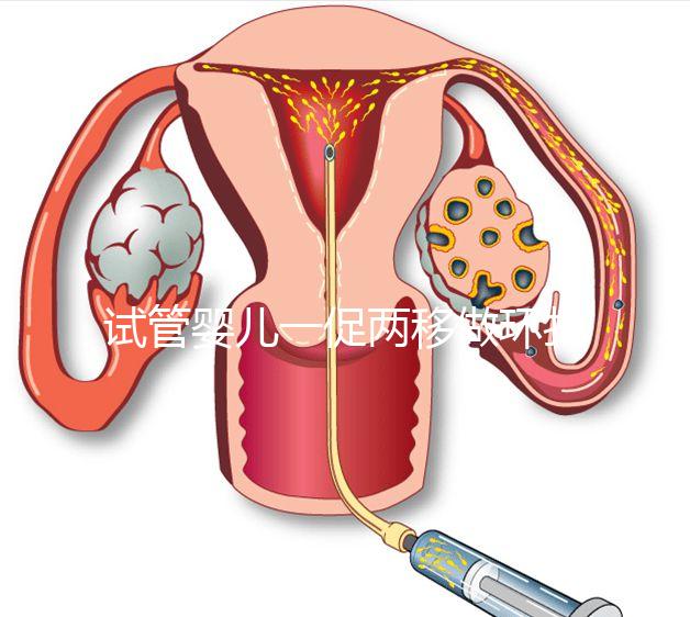 試管嬰兒一促兩移做環扎好看嗎？小心這些影響