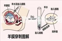 試管嬰兒最大年齡限制（試管嬰兒最大年齡限制是多少）