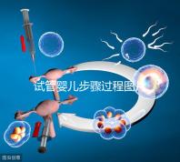 試管嬰兒步驟過程圖片