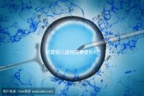 試管嬰兒建檔需要多長時間進來瞧，內含詳細流程供參考