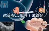 試管嬰兒 囊胚（試管嬰兒囊胚質量等級）