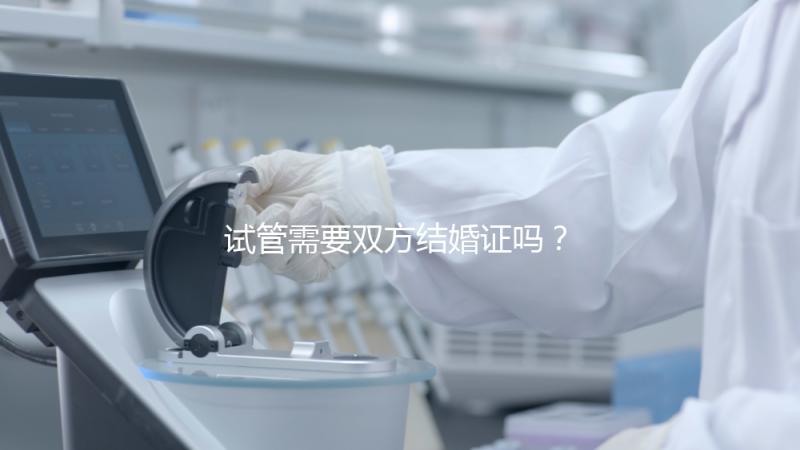 試管需要雙方結(jié)婚證嗎?試管是不是需要結(jié)婚證
