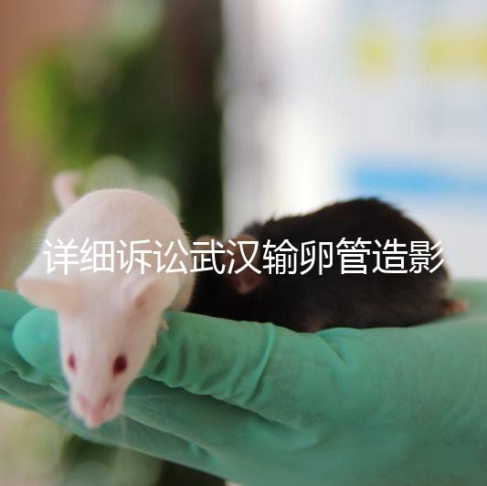 詳細(xì)訴訟武漢輸卵管造影檢查多少錢,能否報(bào)銷,不要錯(cuò)過