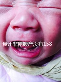 貴州非剖腹產(chǎn)沒(méi)有158天的產(chǎn)假，2024年新規(guī)定告訴你多少天