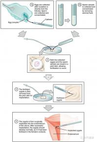 貴陽未婚子女戶口如何向婦女介紹，附2024年結(jié)算流程
