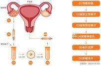赴美考察歸來！HRC醫(yī)院的6位試管嬰兒醫(yī)生是亮點