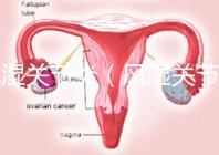 風(fēng)濕關(guān)節(jié)炎（風(fēng)濕關(guān)節(jié)炎的癥狀有哪些）