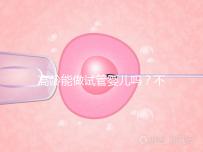 高齡能做試管嬰兒嗎？不是想做就能做得滿足這5個條件