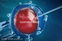 45歲懷孕藥流有風(fēng)險！這4種并發(fā)癥極易影響安全