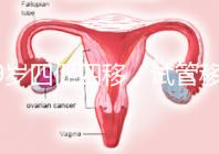 39歲四促四移，試管移植失敗5次后應(yīng)該怎么辦？