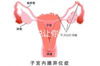 1分鐘解說讓你讀懂，排卵試紙白板一根線等各個反應