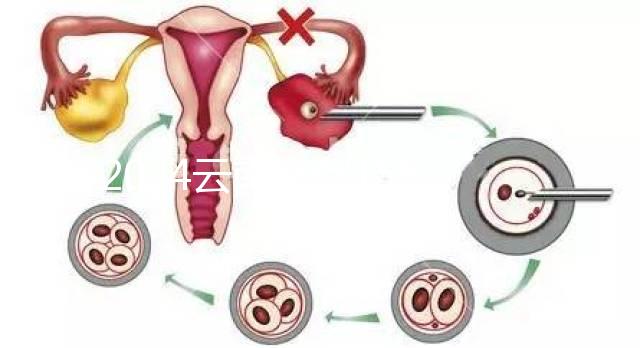 2024云南產假158天怎么算？新政策中，男方培育假貨