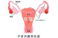 2024年北京海淀區新生兒醫療保險處理策略，照片要求不要出錯