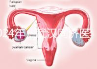 2024年，武漢同濟醫院不孕癥醫生排名公布，選擇專家迅速登記