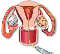 2024武漢免費(fèi)葉酸外國(guó)人可以領(lǐng)取，符合條件就來(lái)江漢區(qū)