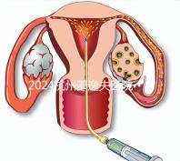 2024杭州邵逸夫醫(yī)院專家門診表，醫(yī)生上班時間一網(wǎng)打盡！