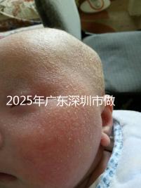 2025年廣東深圳市做第三代試管嬰兒費用，官方收費明細公開！