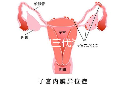 2025昆明三代試管助孕機構收費明細，價格8萬至15萬不等