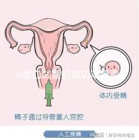 o型血試管的成功率是否高取決于這一點(diǎn)分享真正好的懷孕案例