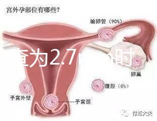 nt檢查為2.7mm時(shí)危險(xiǎn)性莫亂猜,做完無(wú)創(chuàng)后才能確定